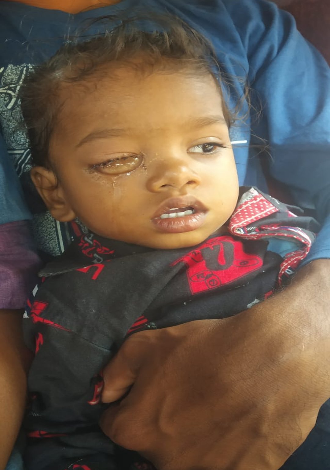 Give African Children's Good medical support